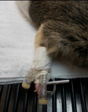IV catheter placement